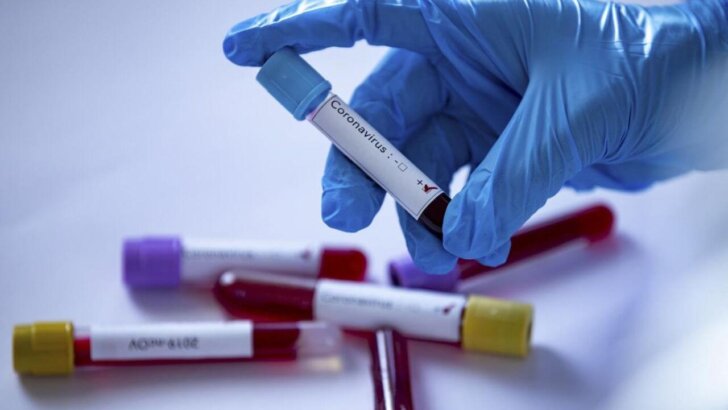 Adana’da Koronavirüs Testi İçin Yetkili Laboratuvar Neresi?