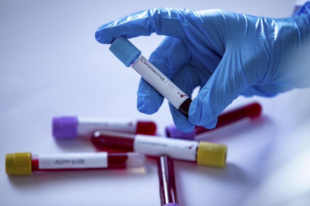 Adana’da Koronavirüs Testi İçin Yetkili Laboratuvar Neresi?